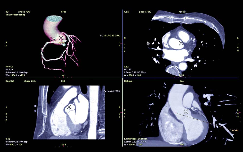 Cardiac Imaging at Florida Radiology Consultants in Fort Myers