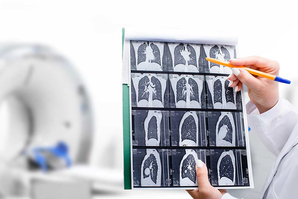 Chest Radiology in Fort Myers