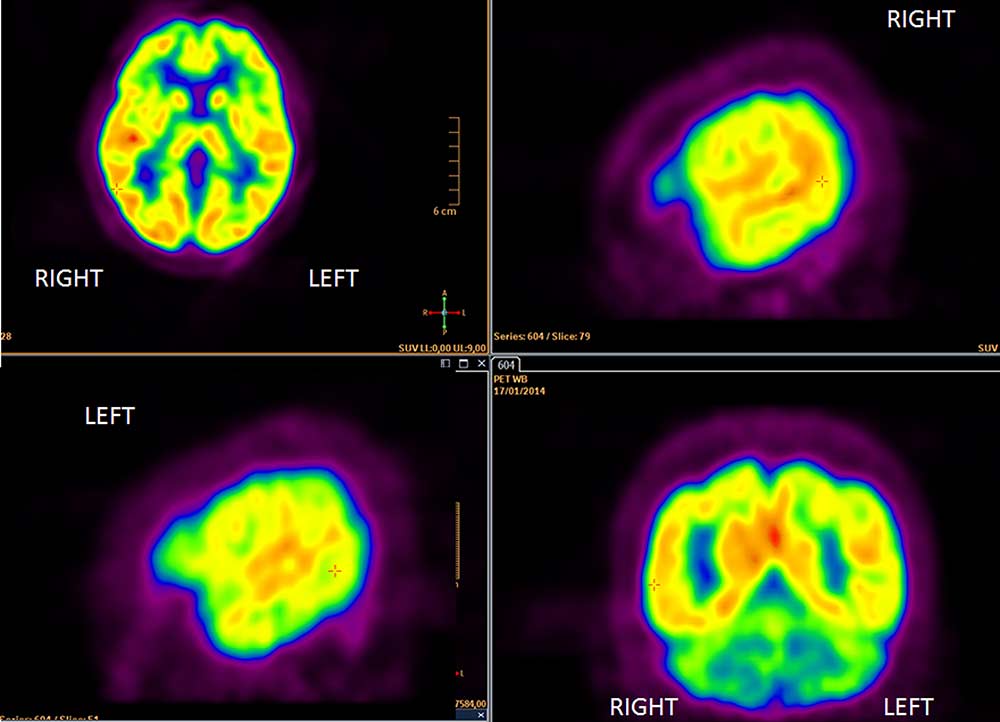 Nuclear Medicine in Fort Myers at Florida Radiology Consultants